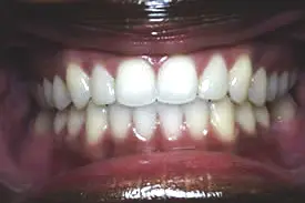 gadson-after-midline