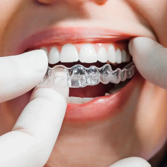 A close-up of a person wearing clear aligners over their teeth. Gloved fingers adjust the aligner. The mood is clinical and focused, highlighting orthodontic care.