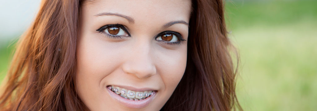 Dr. Heather Brown Orthodontics - Braces Tightening